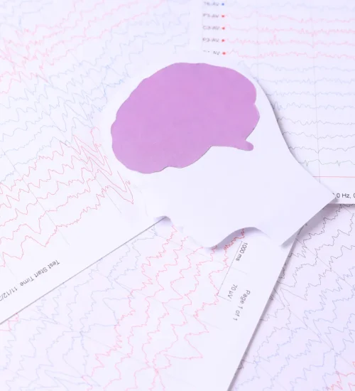 brain-paper-cutout-on-background-of-brain-waves-fr-2025-03-14-23-23-08-utc